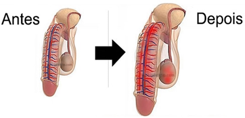 Aumentar Seu Pênis De Forma Segura e Natural