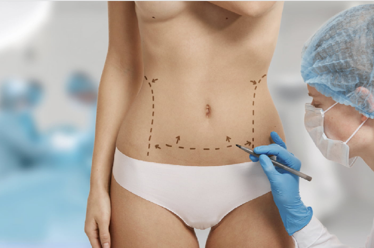 Como se preparar para a cirurgia de contorno corporal pós-perda de peso